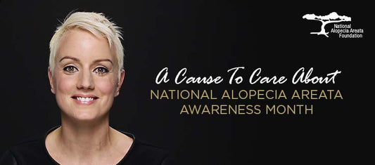 What You Need to Know About Alopecia Areata