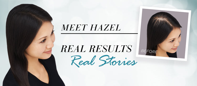 How Toppik Works on Hazel’s Genetic Hair Loss