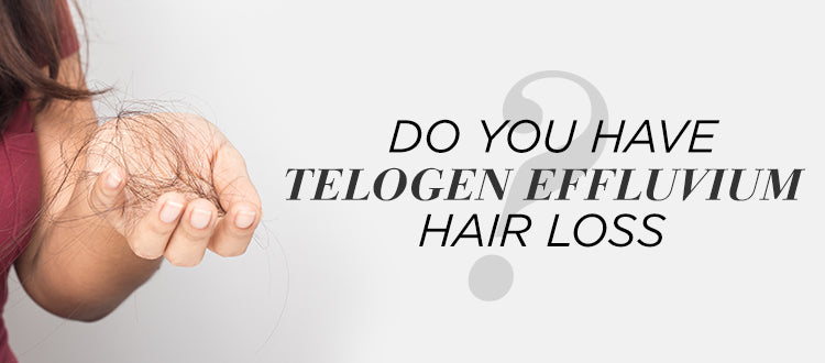 Do You Have Telogen Effluvium Hair Loss?