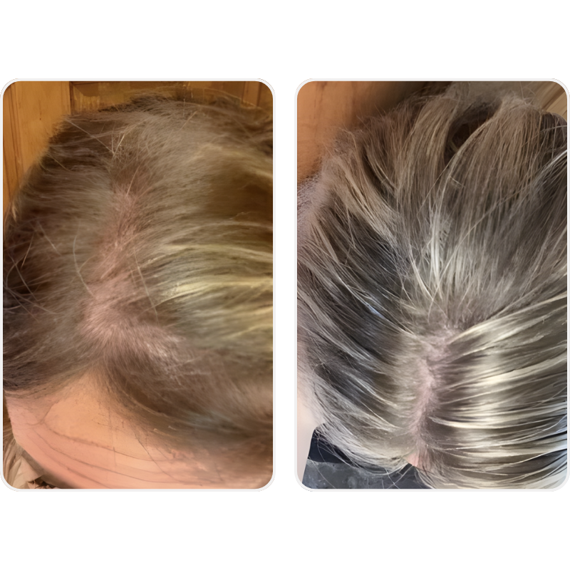 Darla - Viviscal PRO Review