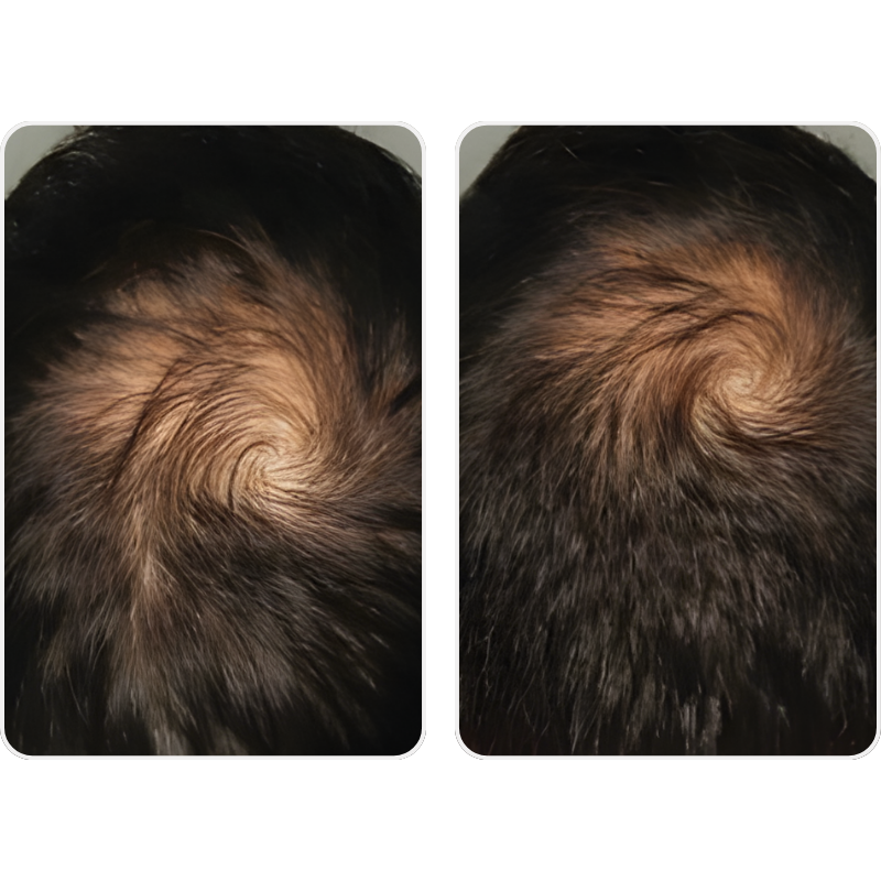 Mark - Viviscal PRO Review