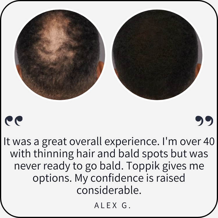 Toppik testimonial by Alex
