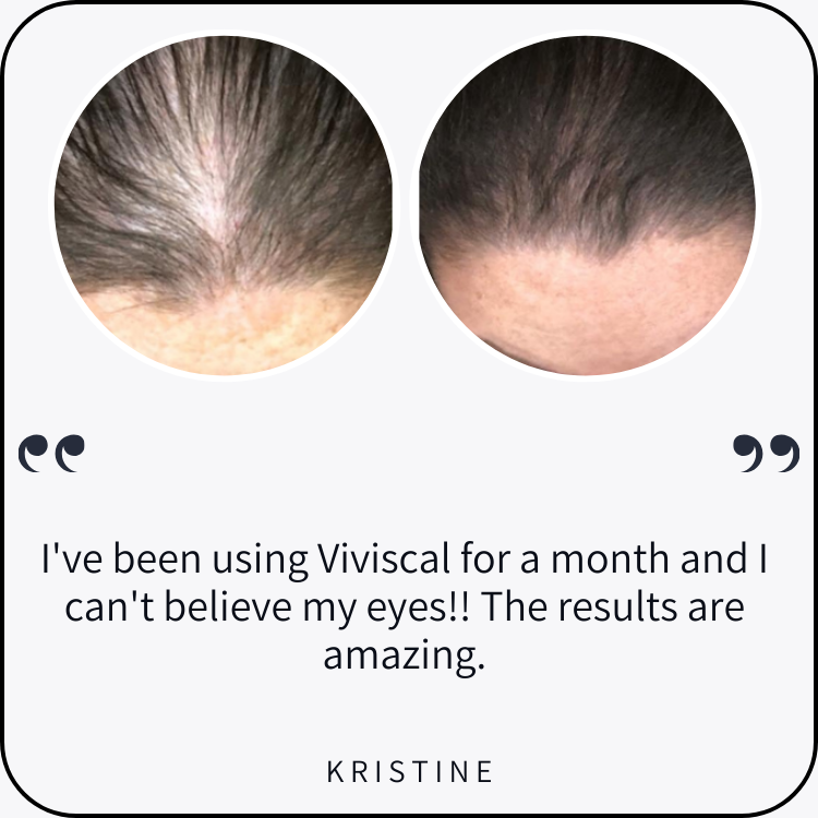 viviscal Professional by Kris