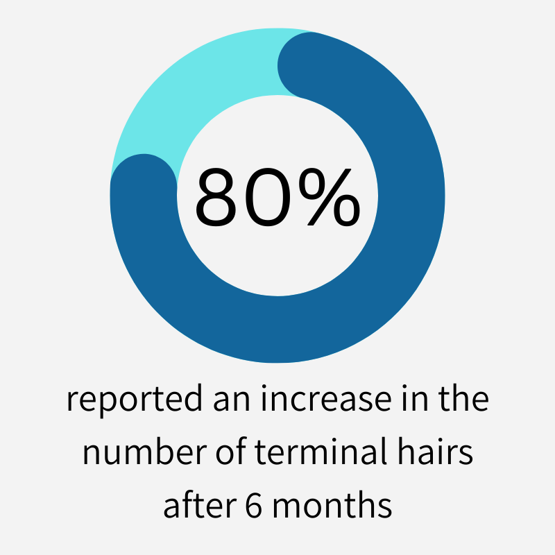 Increase in Terminal Hairs Viviscal PRO